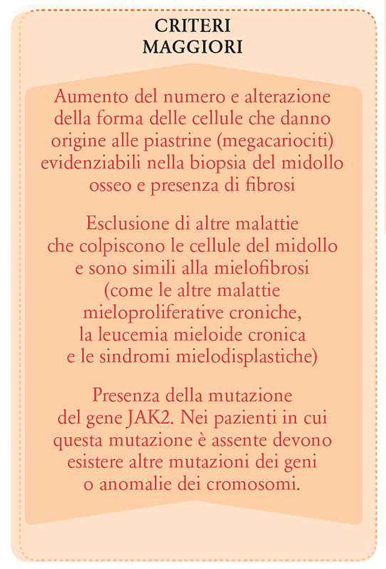 Criteri Maggiori Diagnosi Mielofibrosi